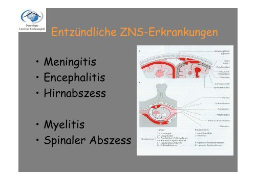 Akute Entzündliche ZNS-Erkrankungen - Luzerner Kantonsspital