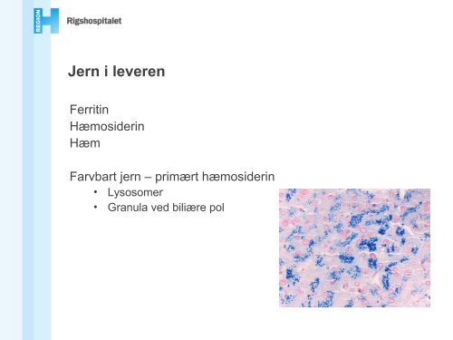 Metaboliske levertilstande