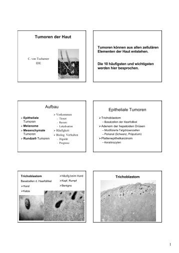 Tumoren der Haut Aufbau Epitheliale Tumoren