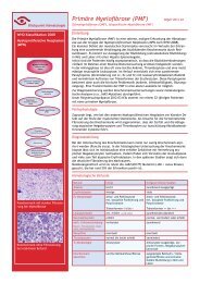 Primäre Myelofibrose (PMF) - mqzh