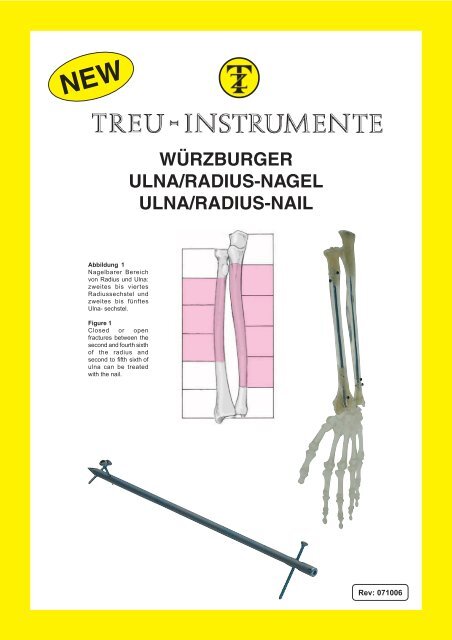 Würzburger Ulna/Radius-Nagel - Treu-Instrumente GmbH