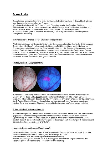 Artikel Pdf Sankt Katharinen Krankenhaus