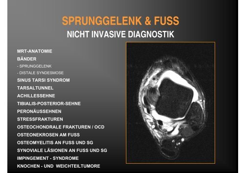 SPRUNGGELENK & FUSS - Diagnosezentrum Meidling