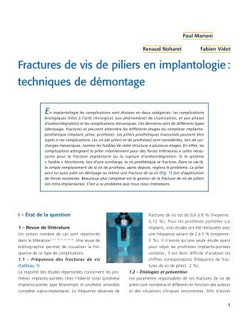 Article Paul Mariani : Fractures de vis - ACIO