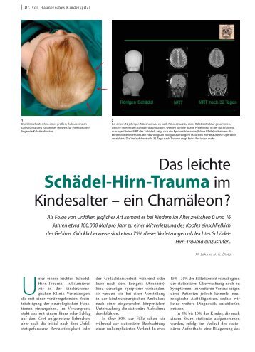 Schädel-Hirn-Trauma im - Hauner Journal