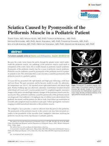 Sciatica Caused by Pyomyositis of the Piriformis Muscle in a ... - Healio