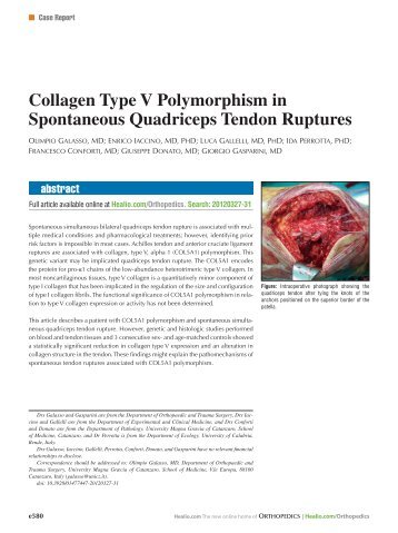Collagen Type V Polymorphism in Spontaneous ... - Healio
