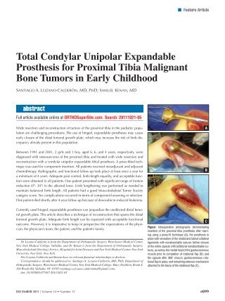 Total Condylar Unipolar Expandable Prosthesis for ... - Healio