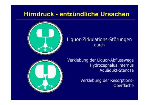 Hirndruck - entzÃ¼ndliche Ursachen