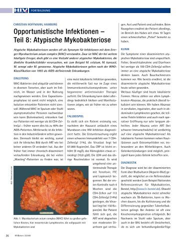 Atypische Mykobakteriose - HIV & More