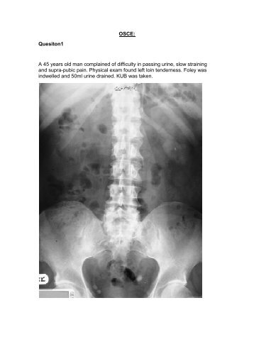 OSCE: Quesiton1 A 45 years old man complained of difficulty in ...