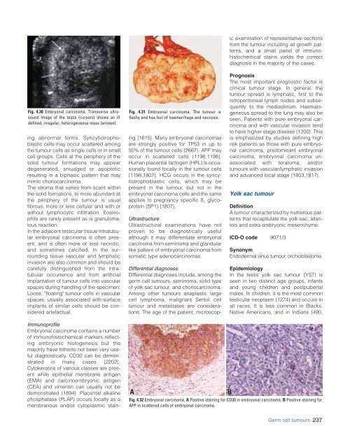 Eble JN, Sauter G., Epstein JI, Sesterhenn IA - iarc