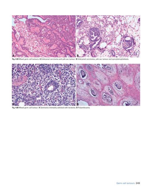 Eble JN, Sauter G., Epstein JI, Sesterhenn IA - iarc