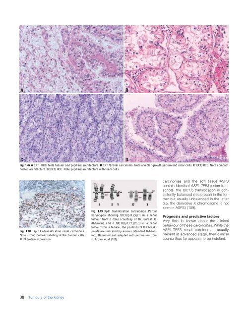 Eble JN, Sauter G., Epstein JI, Sesterhenn IA - iarc