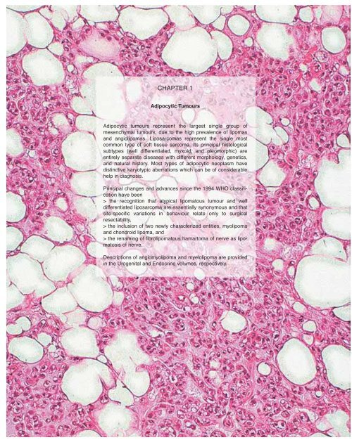 Spindle cell lipoma. (A) A fatty-tumor with interspersed fibro-myxoid