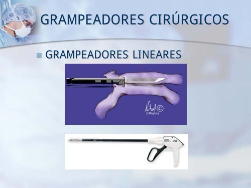 Grampeadores e Suturas. - IJP