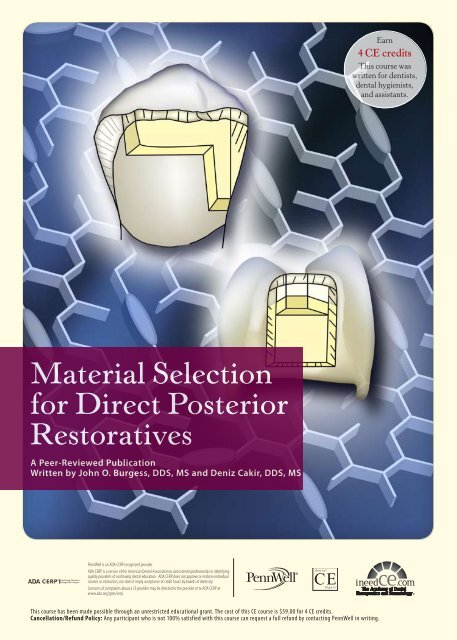 Material Selection for Direct Posterior Restoratives - IneedCE.com