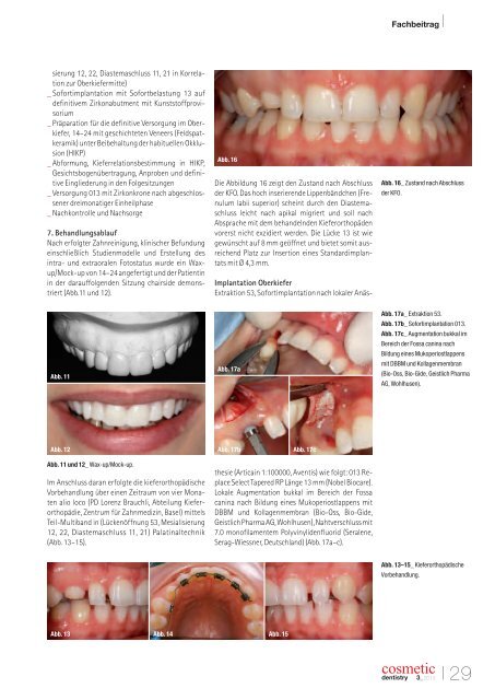 Cosmetic dentistry 03/2013 - AESTHETIKART