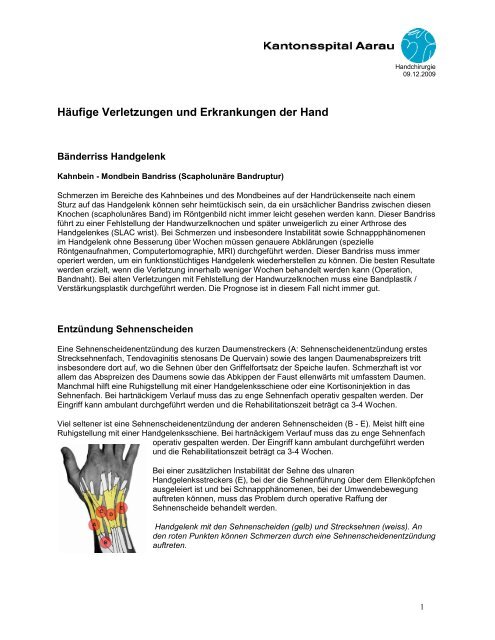 Hilft ein gips bei sehnenscheidenentzündung