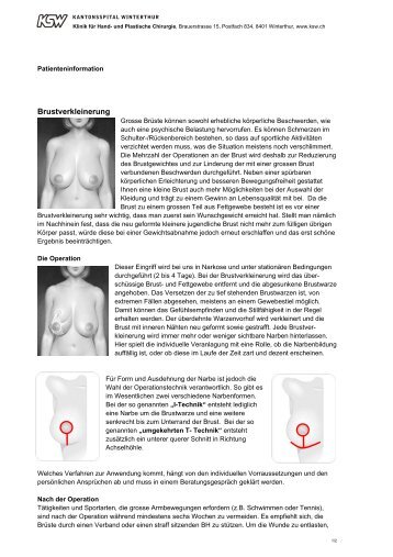 Brustverkleinerung - im Kantonsspital Winterthur