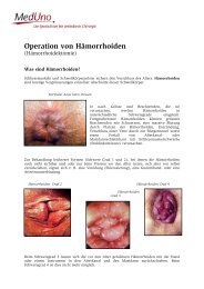 Operation von Hämorrhoiden - MedUno