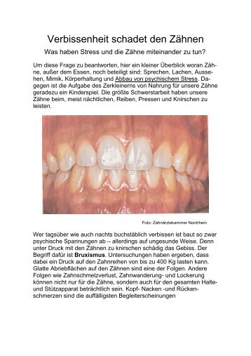 Verbissenheit schadet den Zähnen - Petra Stolle