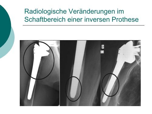 2,7 MB - Klinikum Landkreis Tuttlingen