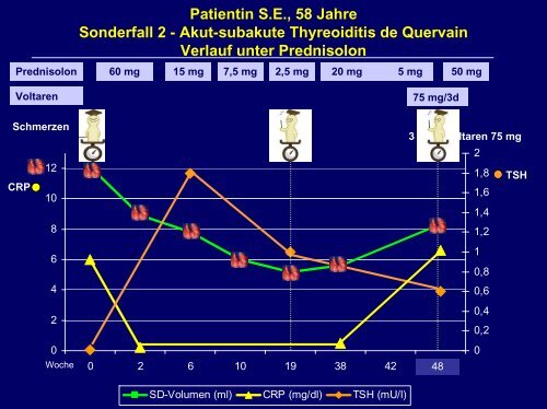 Indikation zur operativen Behandlung von Schilddrüsenerkrankungen