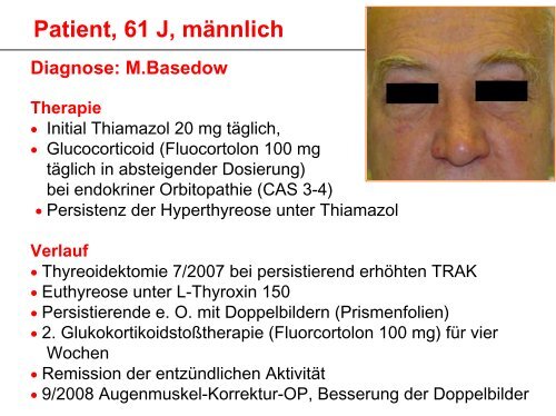 Indikation zur operativen Behandlung von Schilddrüsenerkrankungen