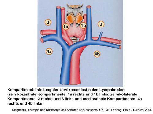 Indikation zur operativen Behandlung von Schilddrüsenerkrankungen