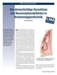 Plastischer Verschluss von Defekten („Löchern“)