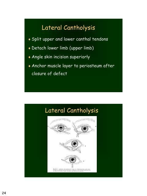 Eyelid Reconstruction