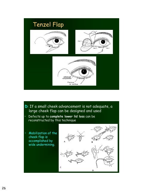 Eyelid Reconstruction
