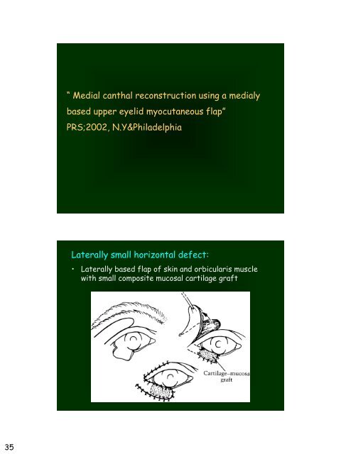 Eyelid Reconstruction