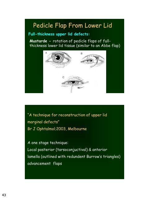 Eyelid Reconstruction