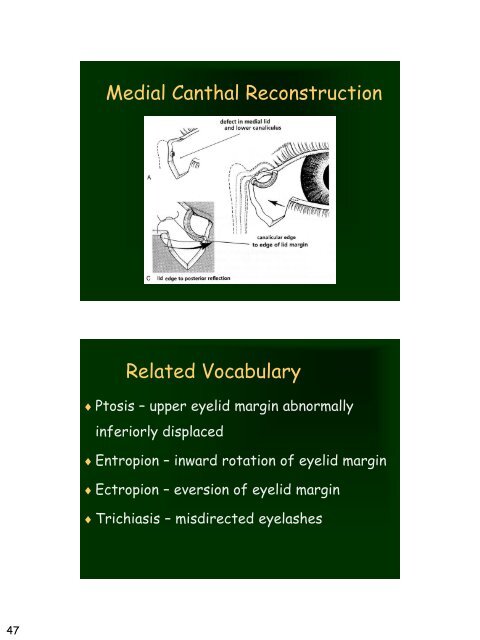 Eyelid Reconstruction