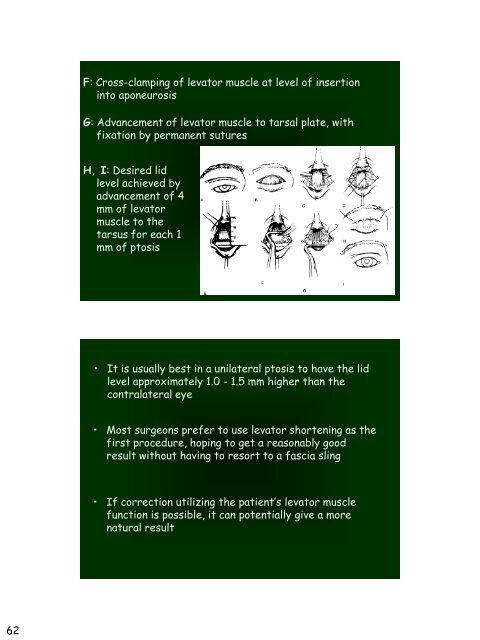 Eyelid Reconstruction