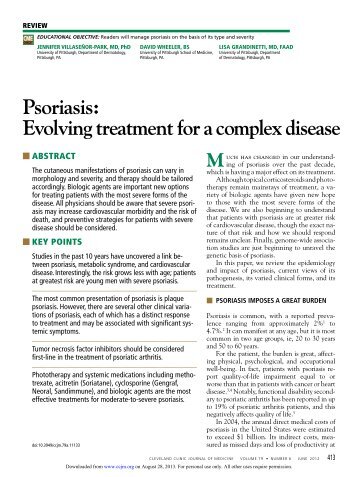 Psoriasis: Evolving treatment for a complex disease - Cleveland ...