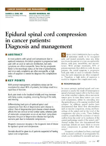 Epidural spinal cord compression in cancer patients - Cleveland ...