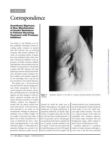 Acanthosis Nigricans: A New Manifestation of Insulin Resistance in ...