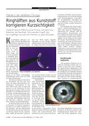 Ringhälften aus Kunststoff korrigieren Kurzsichtigkeit