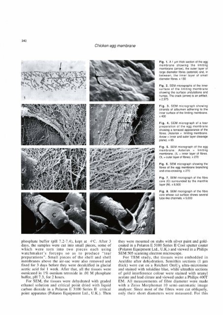 A scanning and transmission electron microscopic study of ... - Digitum