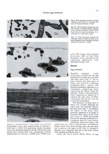 A scanning and transmission electron microscopic study of ... - Digitum