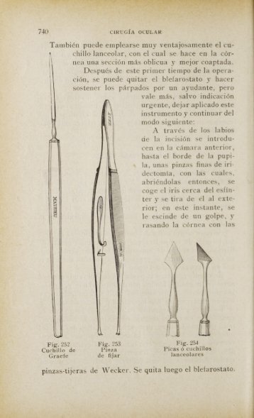 pinzas-tijeras de Wecker. Se quita luego el blefarostato.