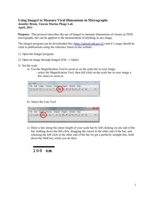 Using Imagej To Measure Viral Dimensions In Micrographs