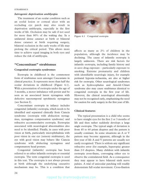 Strabismus - Fundamentals of Clinical Ophthalmology.pdf