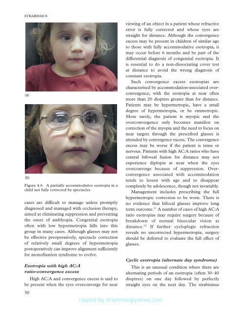 Strabismus - Fundamentals of Clinical Ophthalmology.pdf