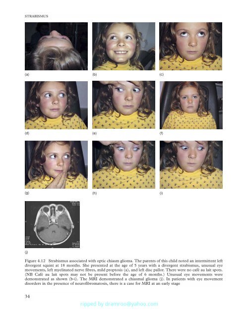 Strabismus - Fundamentals of Clinical Ophthalmology.pdf