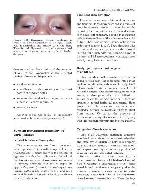 Strabismus - Fundamentals of Clinical Ophthalmology.pdf