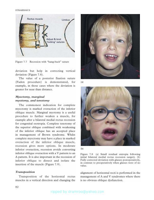 Strabismus - Fundamentals of Clinical Ophthalmology.pdf